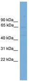 Solute Carrier Family 10 Member 3 antibody, TA331093, Origene, Western Blot image 