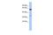 Zinc Finger DHHC-Type Containing 24 antibody, GTX45140, GeneTex, Western Blot image 