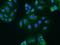 Chloride Voltage-Gated Channel 2 antibody, 201357-T02, Sino Biological, Immunohistochemistry frozen image 