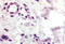C-C chemokine receptor type 10 antibody, MBS240002, MyBioSource, Immunohistochemistry paraffin image 