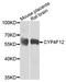 Cytochrome P450 Family 4 Subfamily F Member 12 antibody, 23-336, ProSci, Western Blot image 
