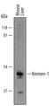 Kringle Containing Transmembrane Protein 1 antibody, AF1647, R&D Systems, Western Blot image 