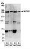 Nucleoporin 205 antibody, NBP2-22287, Novus Biologicals, Western Blot image 