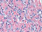 Synaptosome Associated Protein 25 antibody, 49-099, ProSci, Immunohistochemistry paraffin image 