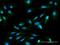 Jupiter Microtubule Associated Homolog 2 antibody, H00090861-M05, Novus Biologicals, Immunofluorescence image 