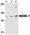 BMI1 Proto-Oncogene, Polycomb Ring Finger antibody, ab38295, Abcam, Western Blot image 