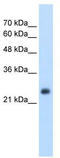 Nicotinamide N-Methyltransferase antibody, TA346428, Origene, Western Blot image 