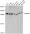 Zinc Finger Matrin-Type 2 antibody, 15-497, ProSci, Western Blot image 