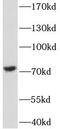 Forkhead box protein O6 antibody, FNab03205, FineTest, Western Blot image 