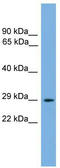 Nuclear Receptor Interacting Protein 2 antibody, TA342346, Origene, Western Blot image 