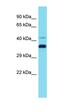 Glycoprotein Integral Membrane 1 antibody, orb326857, Biorbyt, Western Blot image 