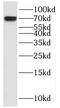 MAX Network Transcriptional Repressor antibody, FNab05257, FineTest, Western Blot image 