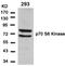 Ribosomal Protein S6 Kinase B1 antibody, AP02762PU-N, Origene, Western Blot image 