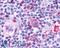 Leukotriene B4 Receptor antibody, LS-A1495, Lifespan Biosciences, Immunohistochemistry paraffin image 