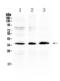 Aldo-Keto Reductase Family 1 Member B10 antibody, LS-C662177, Lifespan Biosciences, Western Blot image 