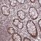 Zinc Finger Protein 85 antibody, PA5-60818, Invitrogen Antibodies, Immunohistochemistry frozen image 