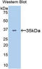 Fms Related Tyrosine Kinase 4 antibody, LS-C299594, Lifespan Biosciences, Western Blot image 