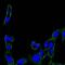 Protein Tyrosine Kinase 2 antibody, GTX82780, GeneTex, Immunocytochemistry image 
