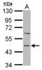 Ectonucleoside Triphosphate Diphosphohydrolase 5 (Inactive) antibody, NBP2-16342, Novus Biologicals, Western Blot image 