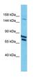 NUS1 Dehydrodolichyl Diphosphate Synthase Subunit antibody, orb326620, Biorbyt, Western Blot image 