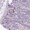 Zinc Finger Protein 697 antibody, HPA049933, Atlas Antibodies, Immunohistochemistry frozen image 