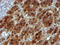 N-Ribosyldihydronicotinamide:Quinone Reductase 2 antibody, M03112-2, Boster Biological Technology, Immunohistochemistry paraffin image 