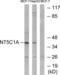 5'-Nucleotidase, Cytosolic IA antibody, LS-B9731, Lifespan Biosciences, Western Blot image 