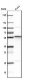 SEC62 Homolog, Preprotein Translocation Factor antibody, NBP1-84045, Novus Biologicals, Western Blot image 