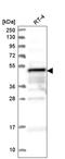 Zinc finger FYVE domain-containing protein 19 antibody, HPA041946, Atlas Antibodies, Western Blot image 