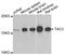 Tachykinin 3 antibody, A6312, ABclonal Technology, Western Blot image 