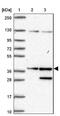 Small Glutamine Rich Tetratricopeptide Repeat Containing Alpha antibody, NBP2-47279, Novus Biologicals, Western Blot image 