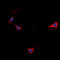 C-X-C Motif Chemokine Receptor 5 antibody, LS-C358998, Lifespan Biosciences, Immunofluorescence image 
