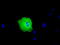 Peroxisomal targeting signal 1 receptor antibody, M02406, Boster Biological Technology, Immunofluorescence image 