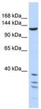 Tankyrase-1 antibody, TA334260, Origene, Western Blot image 