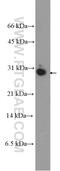 Putative high mobility group protein B3-like-1 antibody, 21246-1-AP, Proteintech Group, Western Blot image 