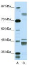 Zinc Finger Protein 607 antibody, TA341420, Origene, Western Blot image 