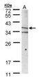 MHC Class I Polypeptide-Related Sequence A antibody, PA5-28181, Invitrogen Antibodies, Western Blot image 