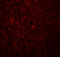 Pleckstrin Homology And RUN Domain Containing M2 antibody, 5485, ProSci, Immunofluorescence image 
