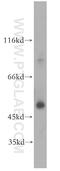Sirtuin 6 antibody, 13572-1-AP, Proteintech Group, Western Blot image 