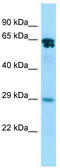 Rac GTPase-activating protein 1 antibody, TA343711, Origene, Western Blot image 