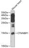 Beta-catenin-interacting protein 1 antibody, 22-718, ProSci, Western Blot image 