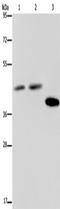 Serpin B3 antibody, TA350172, Origene, Western Blot image 