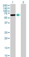 Armadillo repeat-containing X-linked protein 5 antibody, H00064860-B01P, Novus Biologicals, Western Blot image 