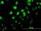 MAP kinase-interacting serine/threonine-protein kinase 2 antibody, H00002872-M04, Novus Biologicals, Immunocytochemistry image 