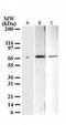 Tumor Protein P73 antibody, TA337074, Origene, Western Blot image 