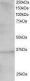 Transcription Factor 19 antibody, PA1-31982, Invitrogen Antibodies, Western Blot image 