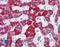 Fanconi anemia group D2 protein antibody, LS-B195, Lifespan Biosciences, Immunohistochemistry paraffin image 
