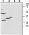 Potassium Calcium-Activated Channel Subfamily M Regulatory Beta Subunit 3 antibody, TA328962, Origene, Western Blot image 