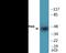Neutrophil Cytosolic Factor 1 antibody, EKC2321, Boster Biological Technology, Western Blot image 