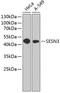 Sestrin 3 antibody, A07894, Boster Biological Technology, Western Blot image 